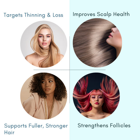 Morfose Scalp Treatment Anti-Hair Loss Serum