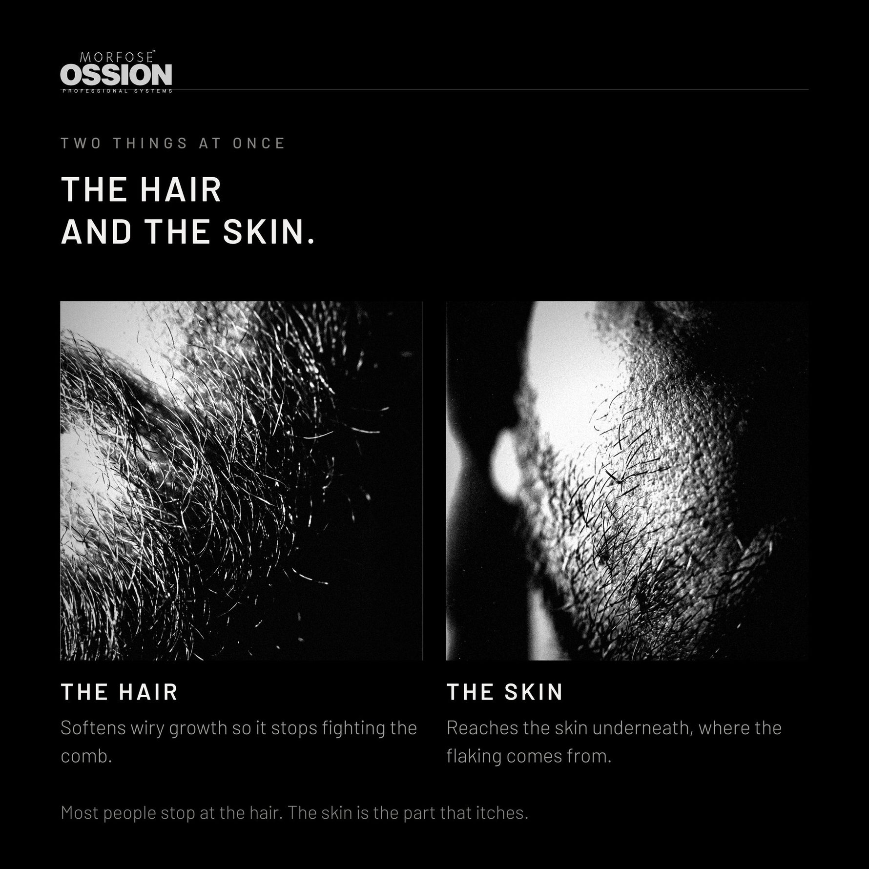 Ossion Beard Oil treats the beard hair and the skin underneath